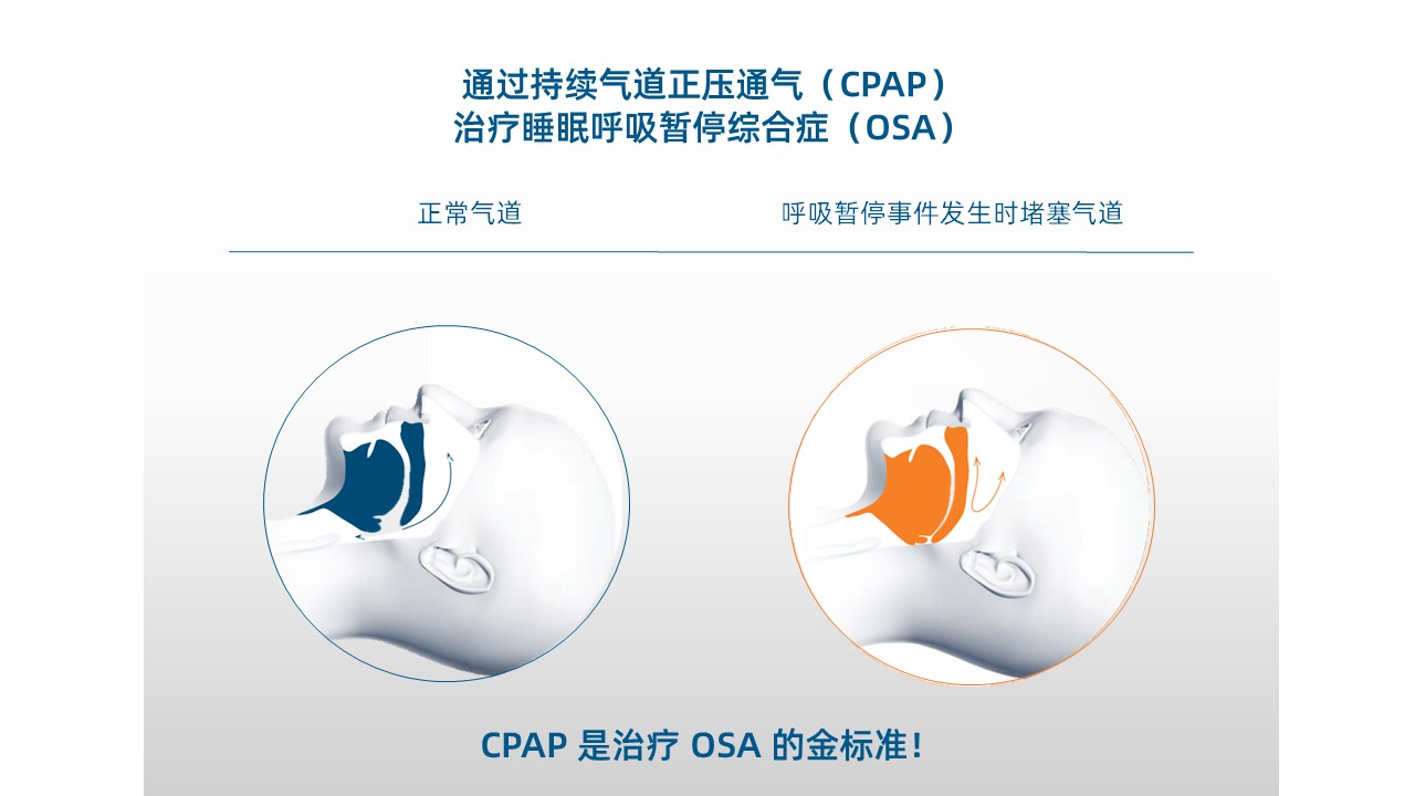 费雪派克爱康系列| 新西兰云展厅| 新西兰贸发局| 新西兰云展厅| 商贸云展厅